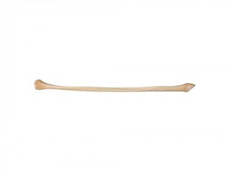 Ulna Shaft