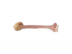 Massive Distal Humerus