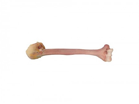 Massive Distal Humerus