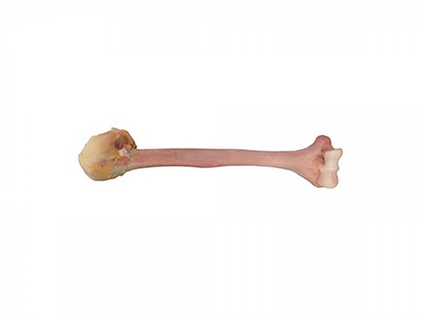 Massive Distal Humerus