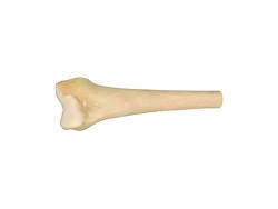 Massive Distal Femur