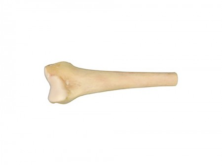 Massive Distal Femur