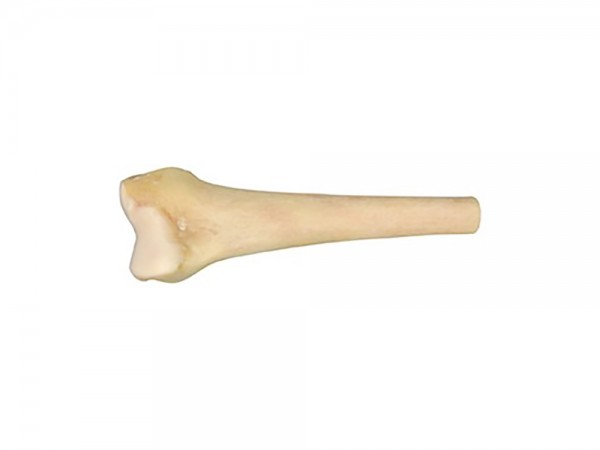 Massive Distal Femur